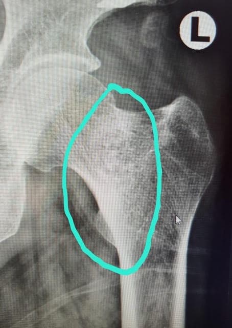 พลัง Digital X-ray